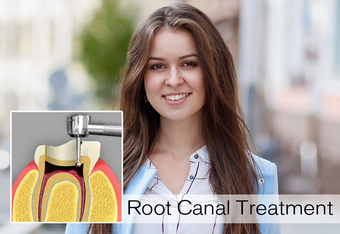 Seven Familiar Indications Conveying That You Require a Root Canal Treatment Seven Familiar Indications Conveying That You Require a Root Canal Treatment